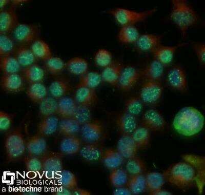 Imaging of Neuro2a Cells Stained Using Conjugated 53BP1 Antibody
